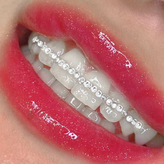 Durée de Vie d'un Strass Dentaire ? Comparatif Complet