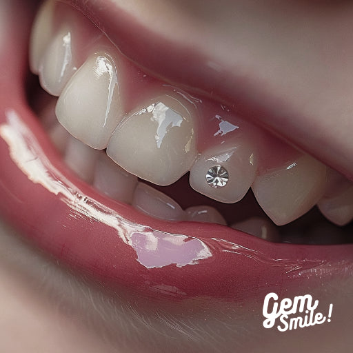 strass dentaire  bijoux dentaire, bijoux dent, strass dent, toothgems DIY