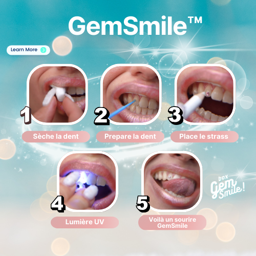 Strass dentaire tuto toothgems DIY Gemsmile