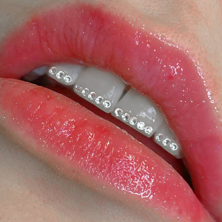 Les strass dentaires abîment-ils les dents ?