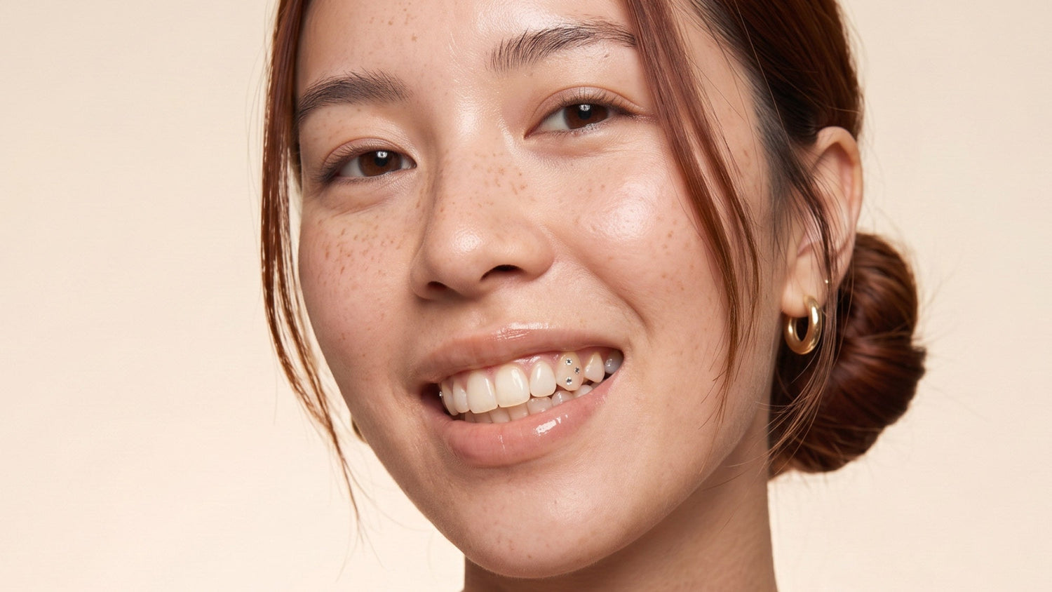 Sourire avec strass dentaire posé avec le kit GemSmile